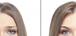 "Les troubles bipolaires. Une dépression peut en cacher une autre!"